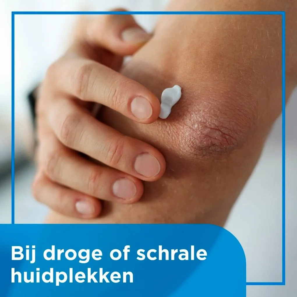 Bepanthen Speciale Huidverzorging>Beschermende Zalf