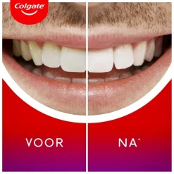 Colgate Whitening Producten><noscript><img width=