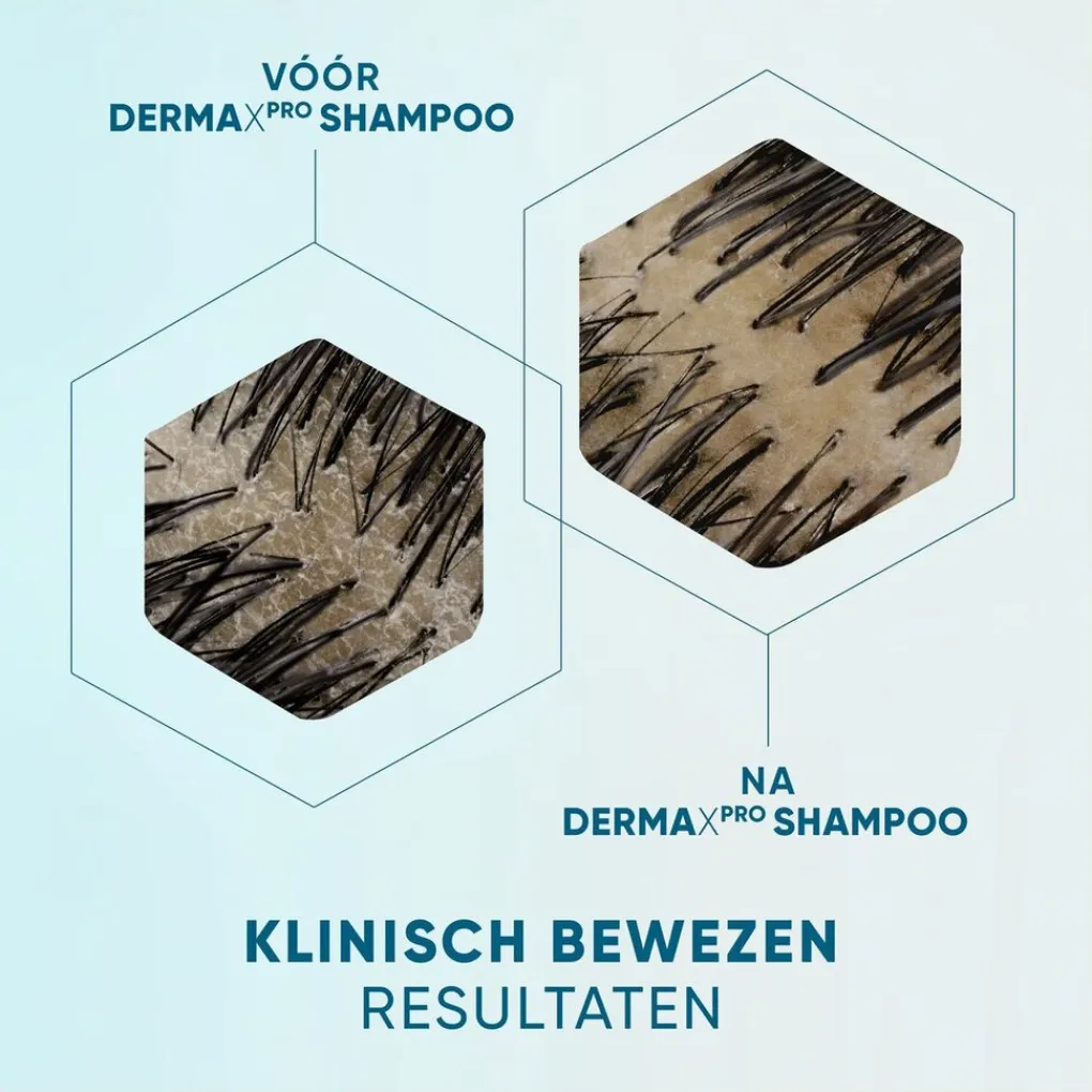 Head & Shoulders Shampoo>DermaXPro by Kalmeert Antiroosshampoo