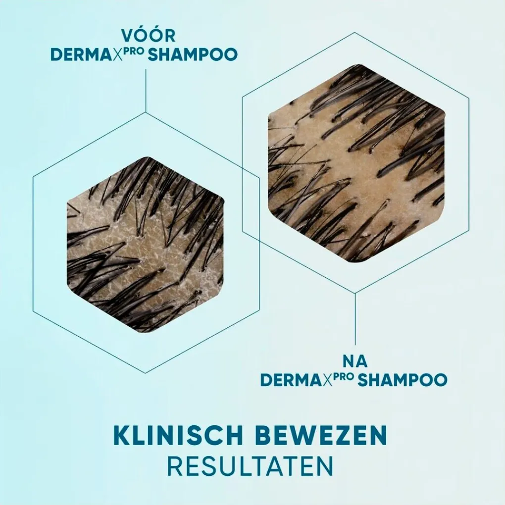 Head & Shoulders Shampoo>DermaXPro by Revitaliseert Antiroosshampoo