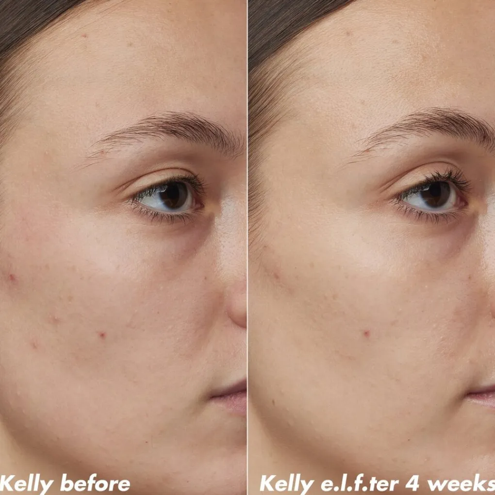 ELF Serum>e.l.f. Skin PLZ Clarify Facial Oil