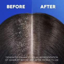 Head & Shoulders Shampoo><noscript><img width=