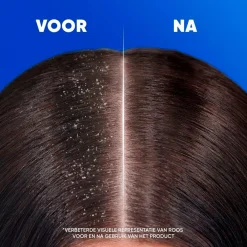 Head & Shoulders Conditioner|Shampoo><noscript><img width=