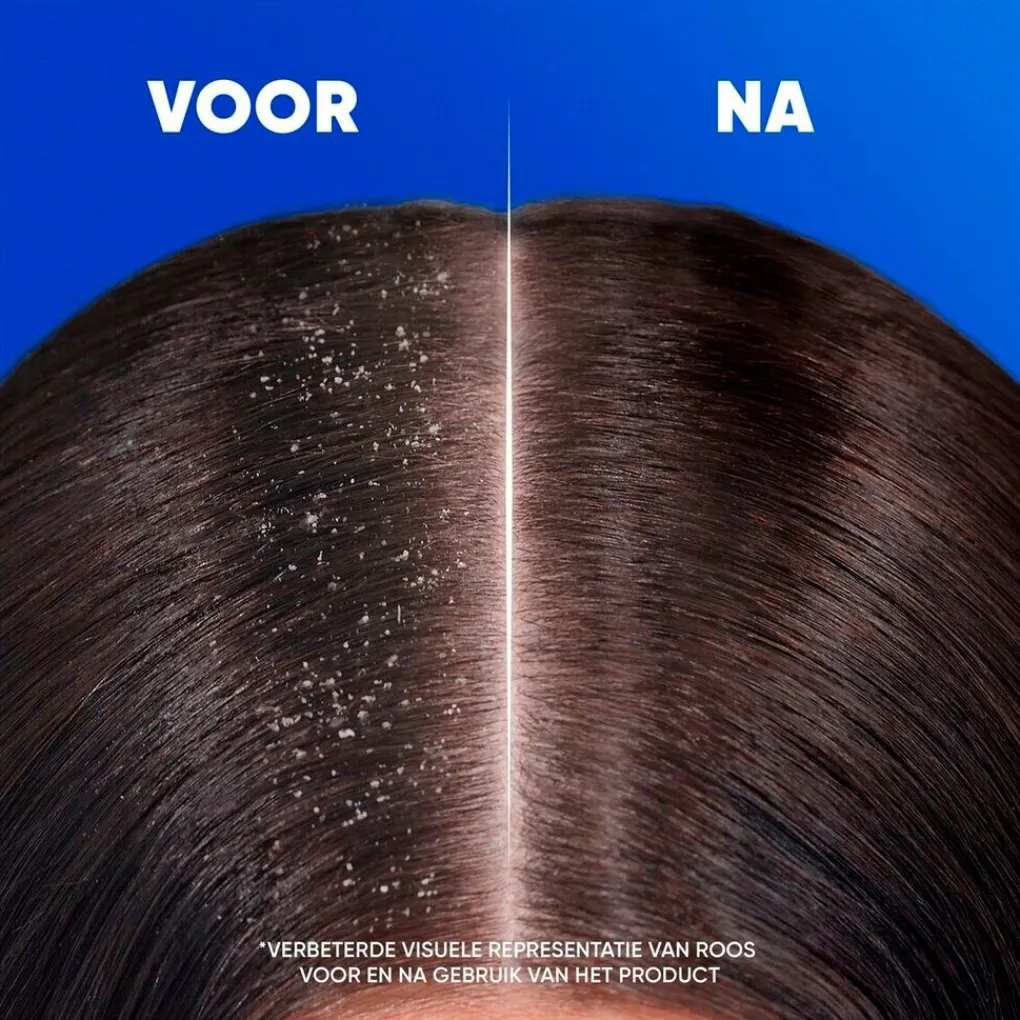 Head & Shoulders Conditioner|Shampoo>Jeukende Hoofdhuid 2-in-1 Antiroosshampoo