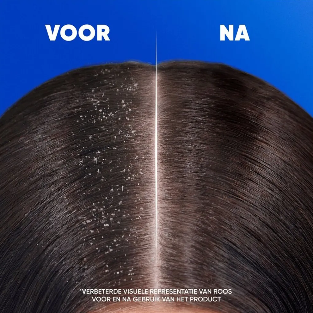Head & Shoulders Shampoo>Jeukende Hoofdhuid Antiroosshampoo
