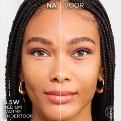 L'Oreal Foundation><noscript><img width=