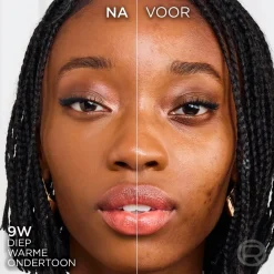 L'Oreal Foundation><noscript><img width=