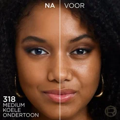 L'Oreal Concealer><noscript><img width=