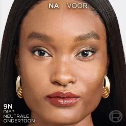 L'Oreal Foundation><noscript><img width=