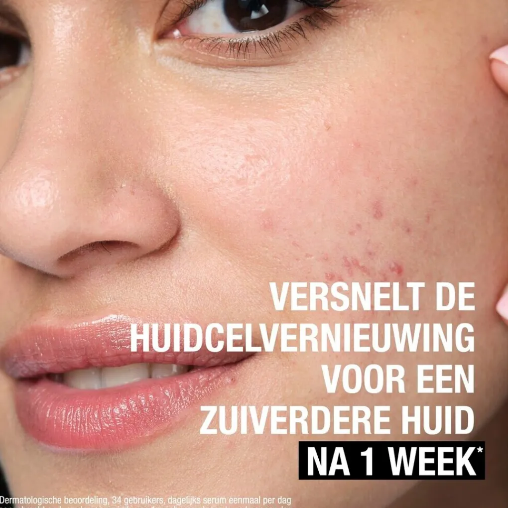 Neutrogena Exfoliant|Dermacare>Anti-Puistjes+ 7% AHA + Panthenol Vloeibare Exfoliant