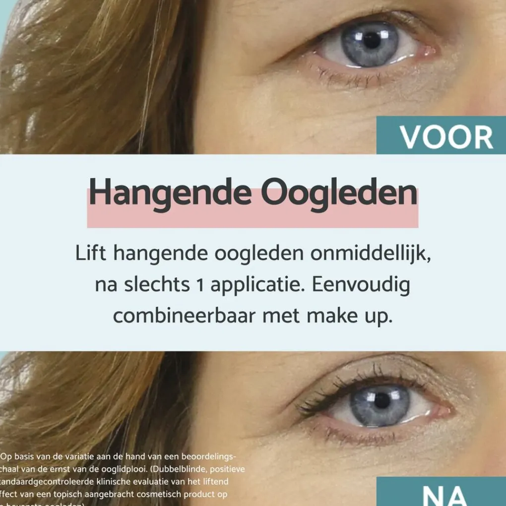 Remescar Oogcreme>Hangende Oogleden Oogcrème
