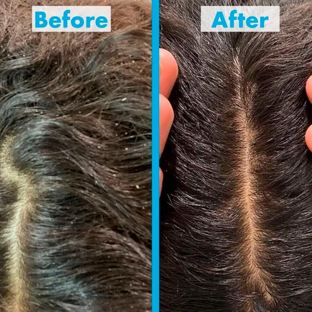Umberto Giannini Shampoo>Scalp Restore Shampoo